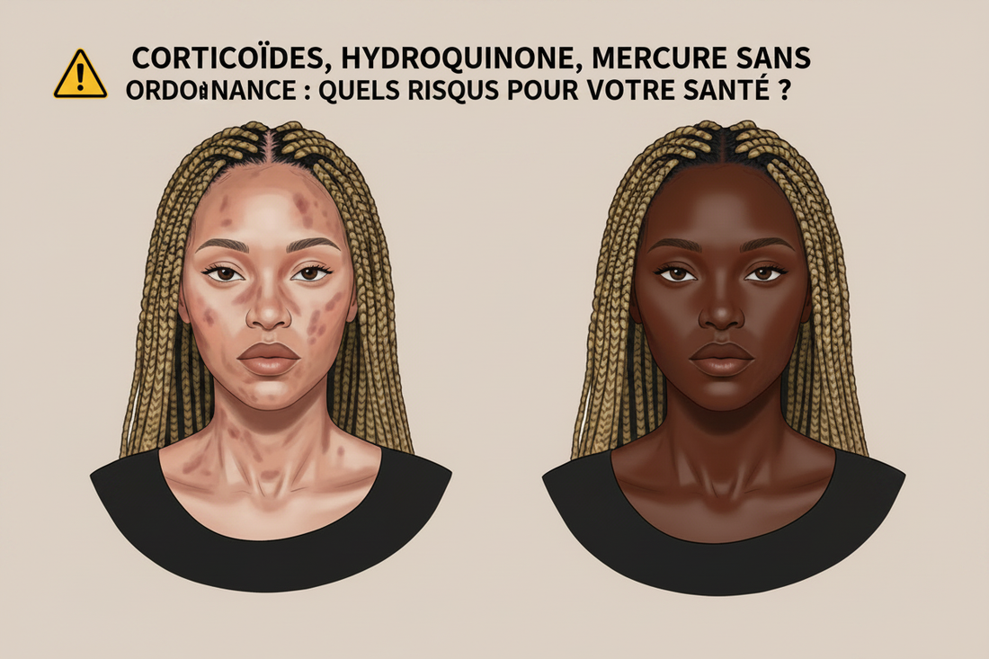 Mercure, corticoïdes, hydroquinone : ce que ces produits font vraiment à votre peau
